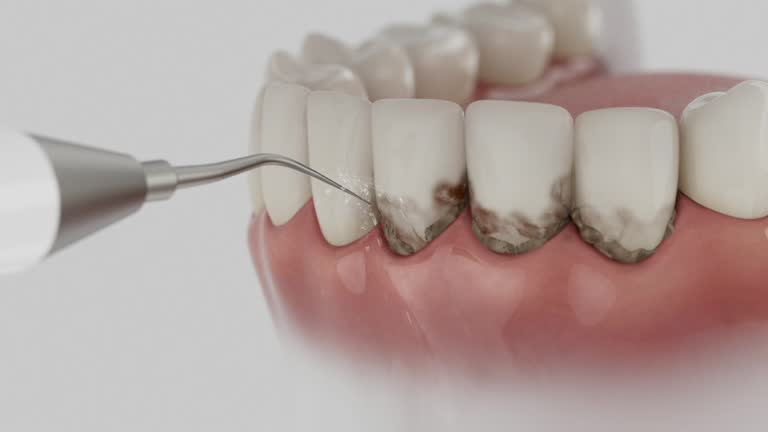 Reliable Dental contractor in Seguin, TX by Smile Center Dentistry